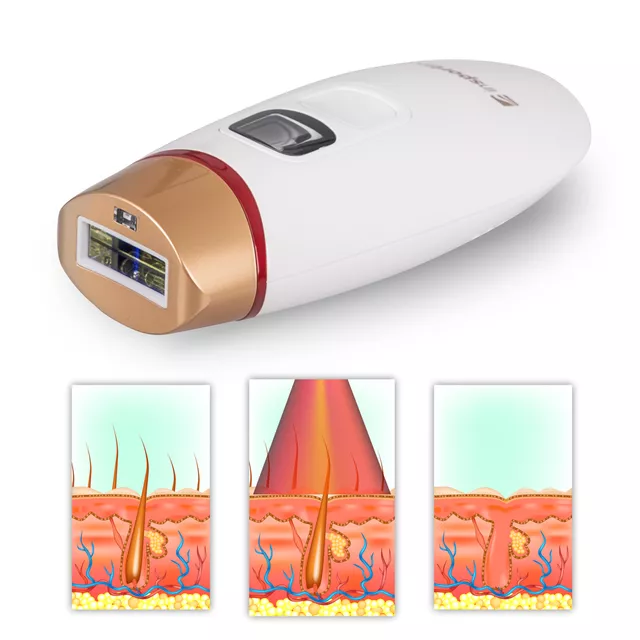 IPL epilátor inSPORTline Eriva, kijelző,  bőrközelség-érzékelés, otthoni használat, védőszemüveg, borotva, ergonomikus kialakítás