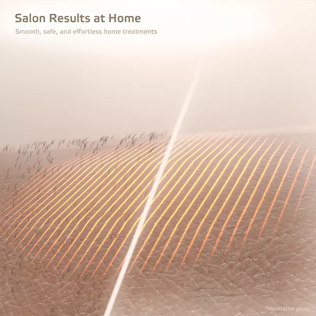 IPL epilátor inSPORTline Aphira, kijelző, bőrközelség-érzékelés, bőrtónus-felismerés, nagy sebességű villanások, 560 nm - 1200 nm hullámhossz