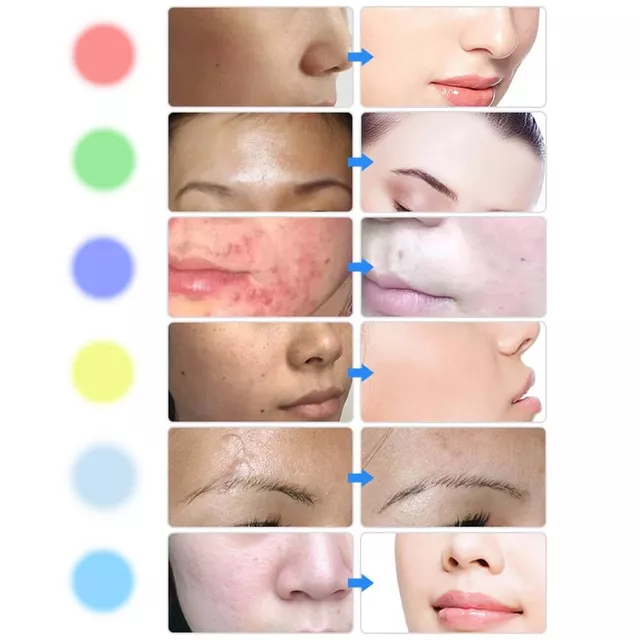 LED fényterápiás arcápoló gép inSPORTline Coladome 900