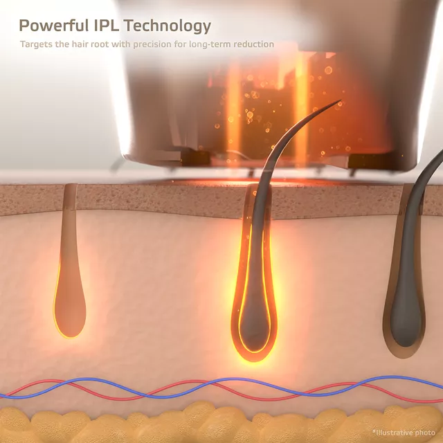 IPL epilátor inSPORTline Eriva, kijelző,  bőrközelség-érzékelés, otthoni használat, védőszemüveg, borotva, ergonomikus kialakítás