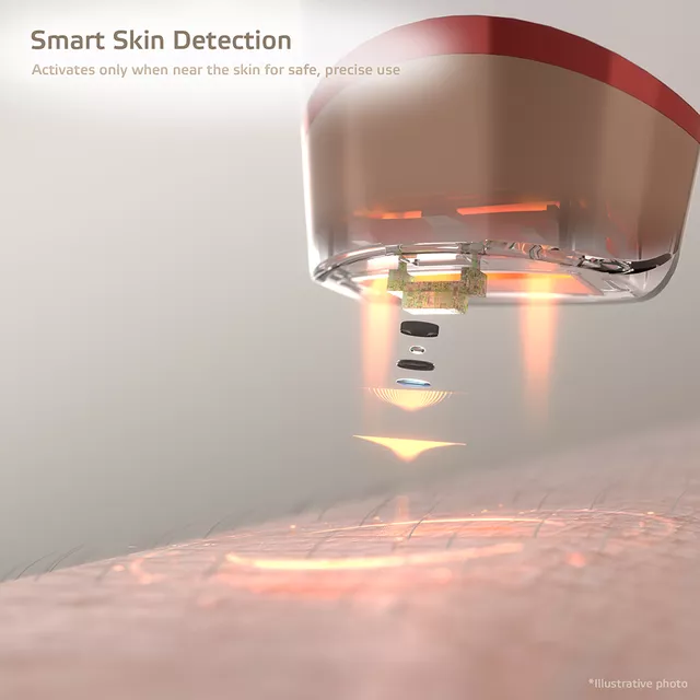 IPL epilátor inSPORTline Eriva, kijelző,  bőrközelség-érzékelés, otthoni használat, védőszemüveg, borotva, ergonomikus kialakítás